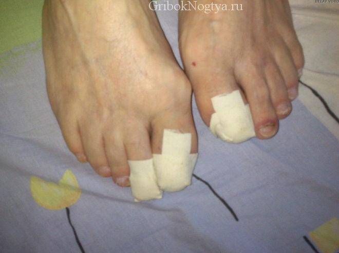 Квиноциклин